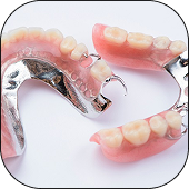 Dentures & Partial Dentures