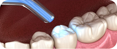 Minimal Removal, Maximum Preservation