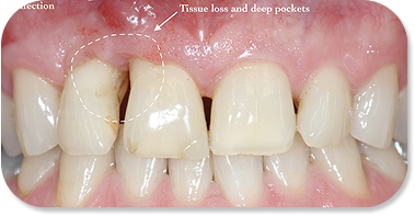 Minimal Removal, Maximum Preservation