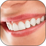 SMILE MAKEOVERS
