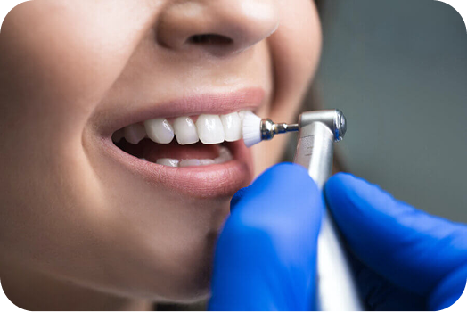 Dental Hygiene Care